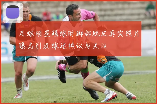 足球明星踢球时脚部脱皮真实照片曝光引发球迷热议与关注